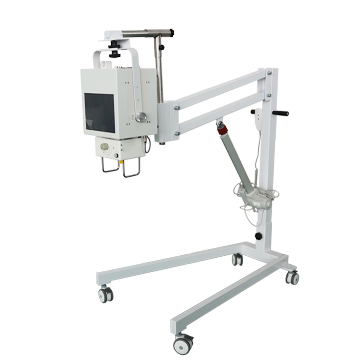 便携式X光机四肢拍摄 移动式X光机